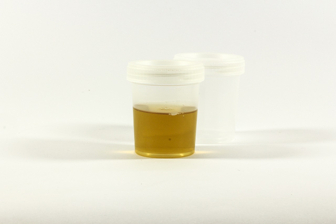Does Delta 8 Show Up On Drug Tests